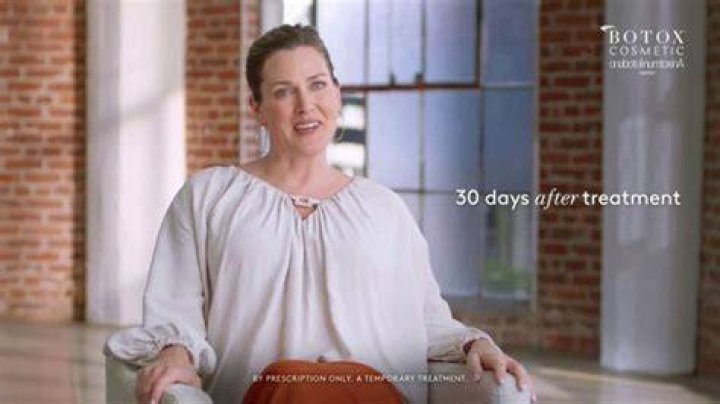 Botox ad Actress: Marie