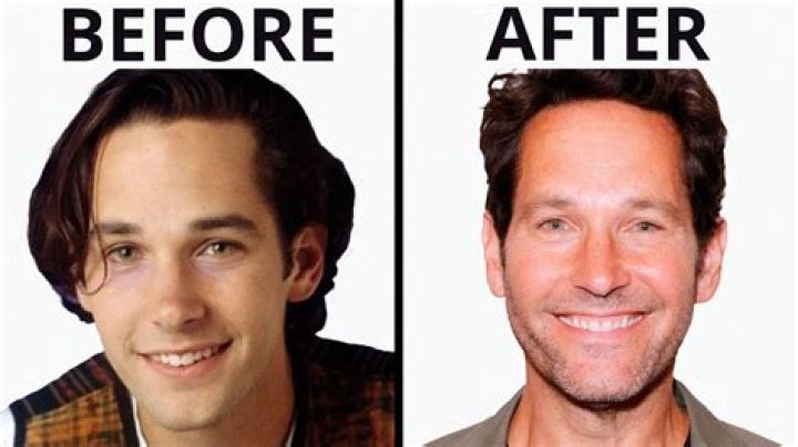 Paul Rudd Plastic Surgery Before and After