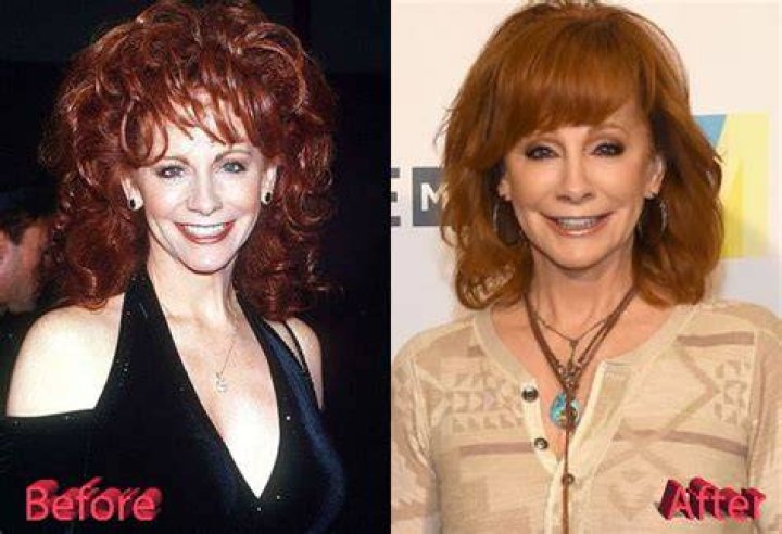Reba McEntire Plastic Surgery: "Has Reba McEntire Had Plastic Surgery?