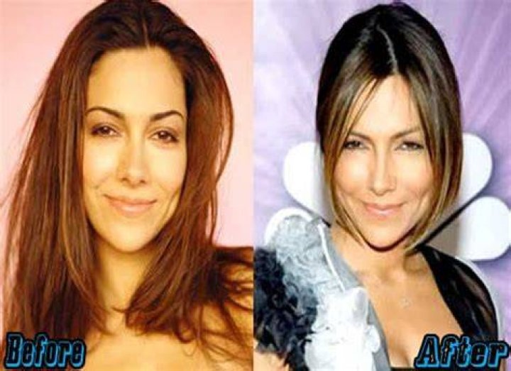 Vanessa Marcil Plastic Surgery Before and After